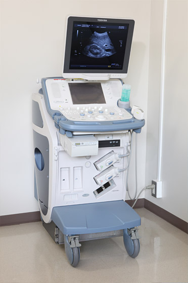 腹部超音波画像診断装置